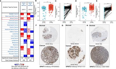 Comprehensive Analysis of the Expression and Prognostic Value of SPINT1/2 in Breast Carcinoma